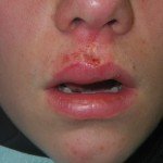 Doylestown Dentist for Children